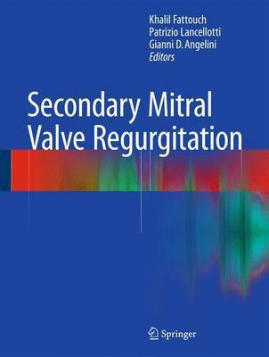 Secondary Mitral Valve Regurgitation(English, Hardcover, unknown)