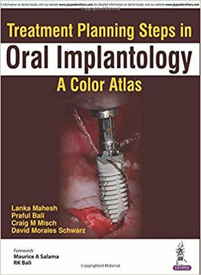 Treatment Planning Steps in Oral Implantology(English, Paperback, Mahesh Lanka)
