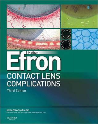 Contact Lens Complications E-Book(English, Electronic book text, Efron Nathan Efron Bscoptom PhD Dsc Faao Fiacle Fcclsa Fbcla Faco)