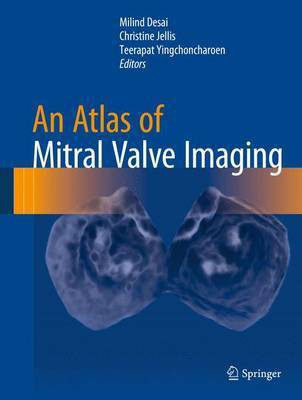 An Atlas of Mitral Valve Imaging(English, Hardcover, unknown)