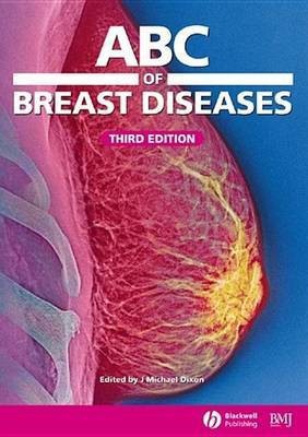 ABC of Breast Diseases(English, Electronic book text, unknown)