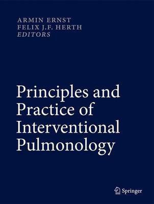 Principles and Practice of Interventional Pulmonology(English, Hardcover, unknown)
