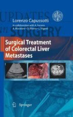 Surgical Treatment of Colorectal Liver Metastases(English, Hardcover, unknown)