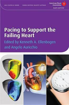 Pacing to Support the Failing Heart(English, Electronic book text, unknown)