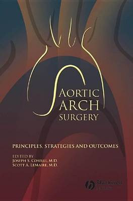 Aortic Arch Surgery(English, Electronic book text, unknown)
