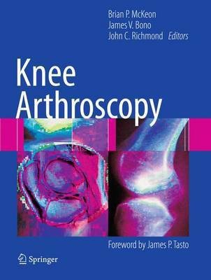 Knee Arthroscopy(English, Paperback, unknown)