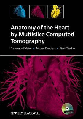 Anatomy of the Heart by Multislice Computed Tomography(English, Electronic book text, Faletra Francesco)