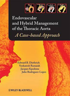 Endovascular and Hybrid Management of the Thoracic Aorta(English, Electronic book text, Diethrich Edward B.)