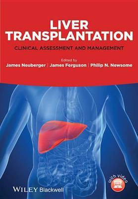 Liver Transplantation(English, Electronic book text, unknown)