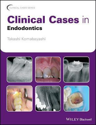 Clinical Cases in Endodontics(English, Electronic book text, Komabayashi Takashi)