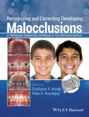 Recognizing and Correcting Developing Malocclusions(English, Electronic book text, unknown)