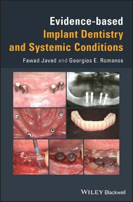 Evidence-based Implant Dentistry and Systemic Conditions(English, Electronic book text, Javed Fawad)