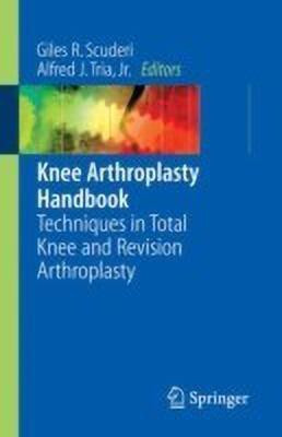 Knee Arthroplasty Handbook(English, Paperback, unknown)