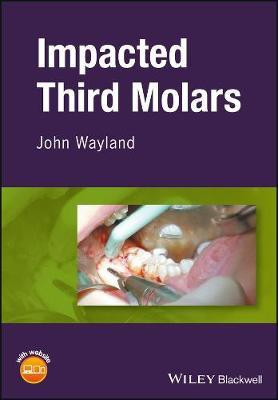 Impacted Third Molars(English, Electronic book text, Wayland John)