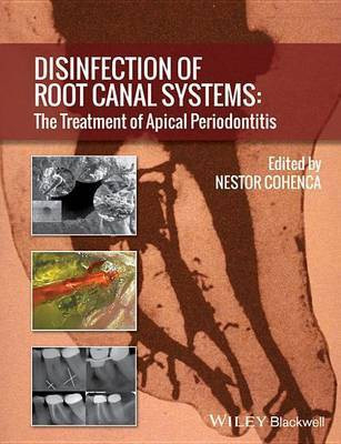 Disinfection of Root Canal Systems(English, Electronic book text, unknown)
