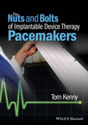 The Nuts and Bolts of Implantable Device Therapy(English, Electronic book text, Kenny Tom)