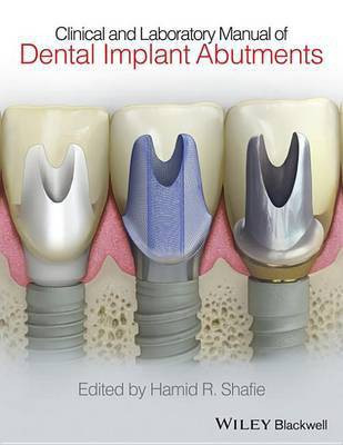 Clinical and Laboratory Manual of Dental Implant Abutments(English, Electronic book text, Shafie Hamid R.)