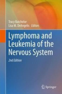 Lymphoma and Leukemia of the Nervous System(English, Hardcover, unknown)