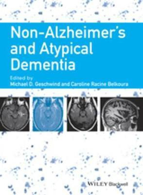 Non-Alzheimer's and Atypical Dementia(English, Electronic book text, unknown)