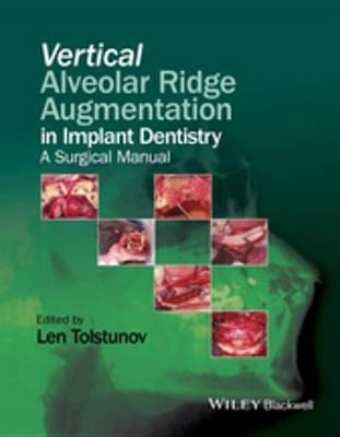 Vertical Alveolar Ridge Augmentation in Implant Dentistry(English, Electronic book text, unknown)