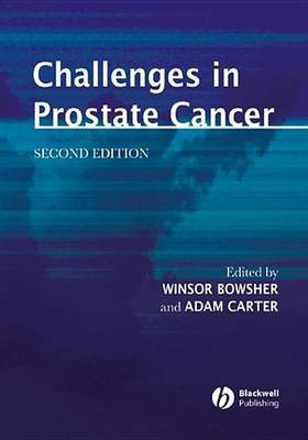 Challenges in Prostate Cancer(English, Electronic book text, unknown)