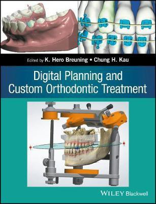 Digital Planning and Custom Orthodontic Treatment(English, Electronic book text, unknown)