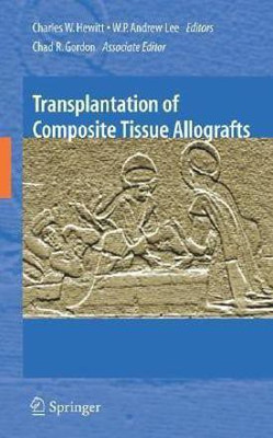 Transplantation of Composite Tissue Allografts(English, Hardcover, unknown)