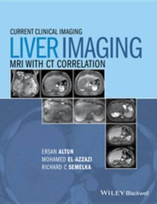 Liver Imaging(English, Electronic book text, unknown)