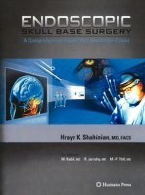 Endoscopic Skull Base Surgery(English, Paperback, Shahinian Hrayr K.)