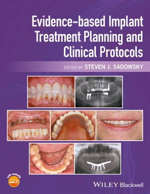 Evidence-based Implant Treatment Planning and Clinical Protocols(English, Hardcover, unknown)