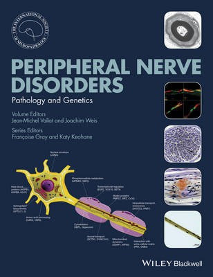 Peripheral Nerve Disorders(English, Hardcover, unknown)