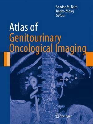 Atlas of Genitourinary Oncological Imaging(English, Hardcover, unknown)