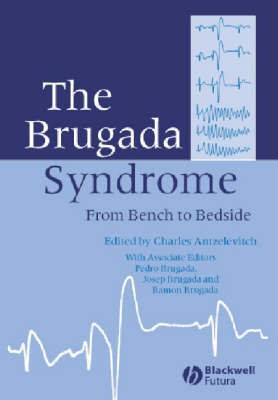 The Brugada Syndrome(English, Hardcover, unknown)