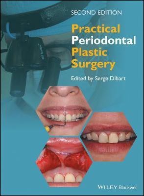 Practical Periodontal Plastic Surgery(English, Hardcover, unknown)