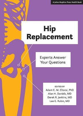 Hip Replacement(English, Paperback, unknown)