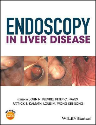 Endoscopy in Liver Disease(English, Electronic book text, unknown)