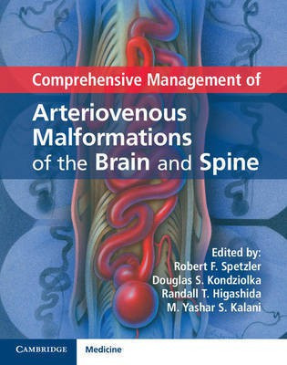 Comprehensive Management of Arteriovenous Malformations of the Brain and Spine(English, Hardcover, unknown)
