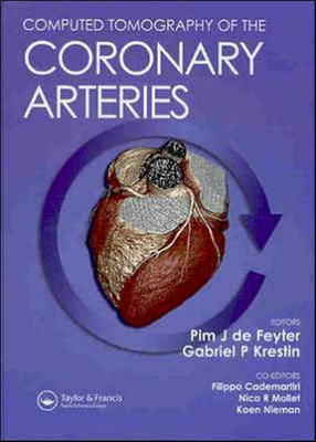 Computed Tomography of the Coronary Arteries(English, Hardcover, Pim de Feyter)
