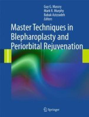 Master Techniques in Blepharoplasty and Periorbital Rejuvenation(English, Hardcover, unknown)