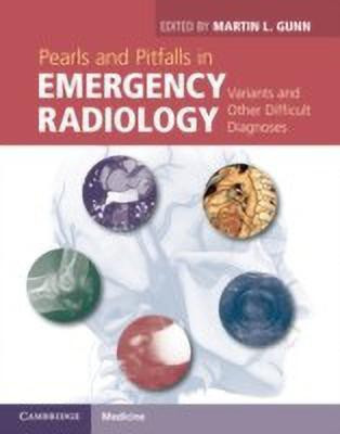 Pearls and Pitfalls in Emergency Radiology(English, Hardcover, unknown)