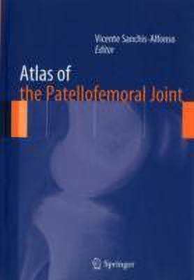 Atlas of the Patellofemoral Joint(English, Paperback, unknown)