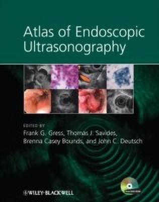 Atlas of Endoscopic Ultrasonography(English, Hardcover, unknown)