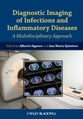 Diagnostic Imaging of Infections and Inflammatory Diseases(English, Hardcover, unknown)