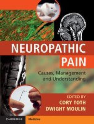 Neuropathic Pain(English, Hardcover, unknown)
