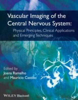 Vascular Imaging of the Central Nervous System(English, Hardcover, unknown)