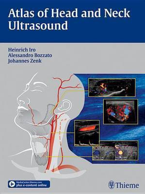 Atlas of Head and Neck Ultrasound(English, Electronic book text, Iro Heinrich)