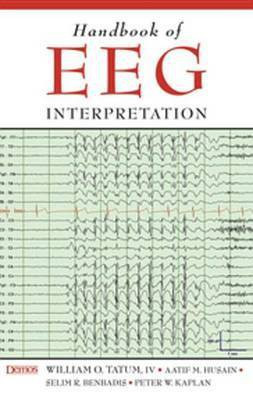Handbook of EEG Interpretation(English, Electronic book text, Tatum William O)