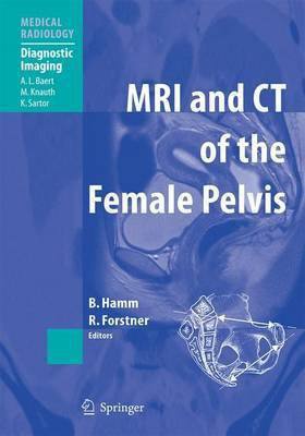 MRI and Ct of the Female Pelvis(English, Electronic book text, Hamm Bernd)