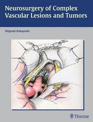 Neurosurgery of Complex Vascular Lesions and Tumors(English, Hardcover, unknown)