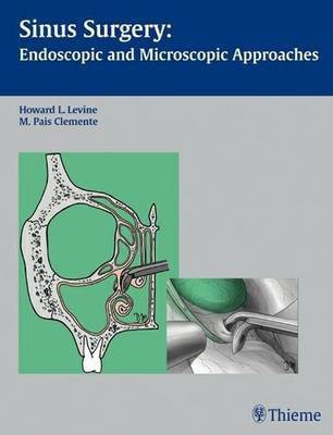 Sinus Surgery(English, Hardcover, unknown)